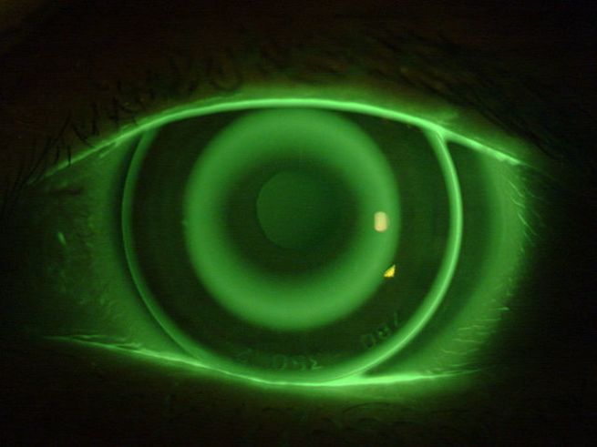 學童近視風險評估及遁證非藥物近視管理諮詢計劃 - iCARE EYECARE 護眼·家