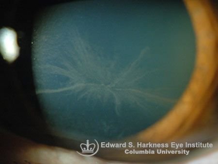 基礎眼科視光檢查 - iCARE EYECARE 護眼·家