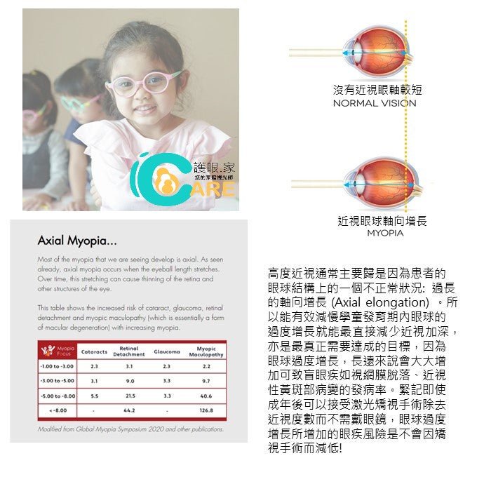 學童近視風險評估及遁證非藥物近視管理諮詢計劃 - iCARE EYECARE 護眼·家