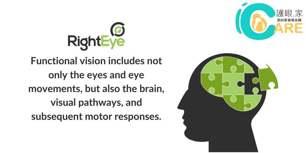 斜視, 雙眼協調, 動態及運動視能分析及訓練建議 - iCARE EYECARE 護眼·家